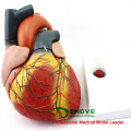 HEART11 (12487) New Oversize 4xlife size Modelo de anatomía del corazón Separado en 4 partes